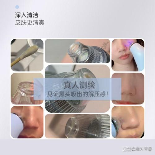 吸黑头仪哪个品牌好用?2026年推荐的10款型号:性价比高效果好!